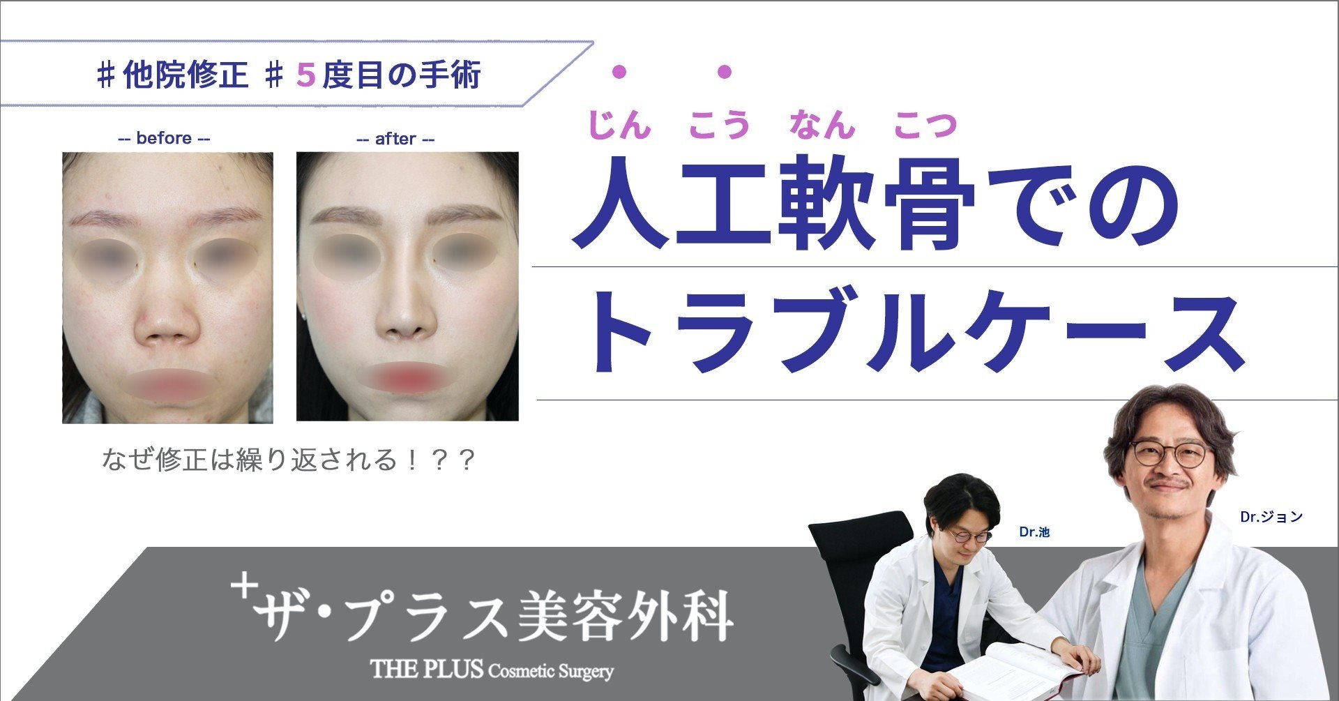 他院修正・人工軟骨でのトラブルケース｜ザ・プラス美容外科