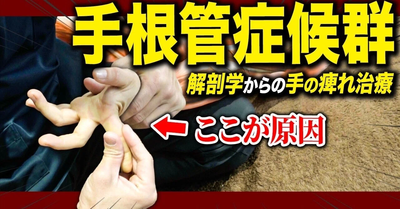 Treatment for Hand Numbness in Carpal Tunnel Syndrome | How to Identify ...