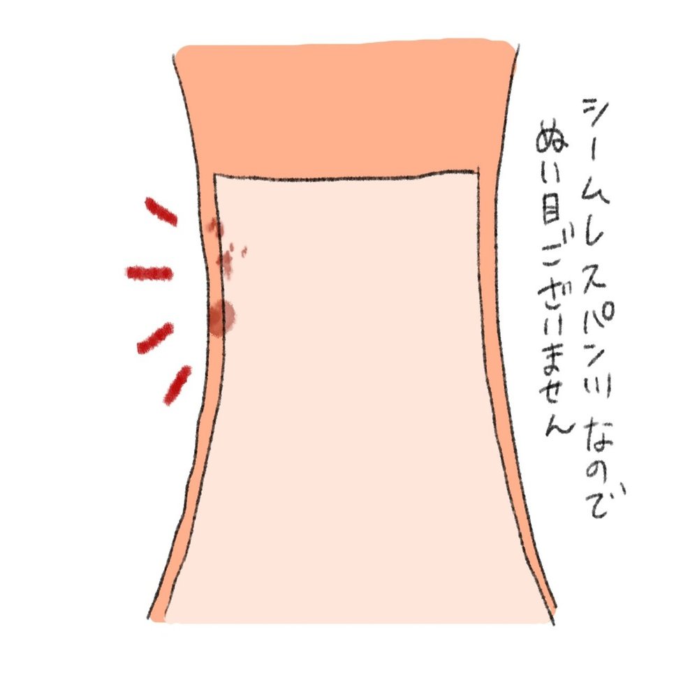 パンツのゴムでできたおできの記録 F Note