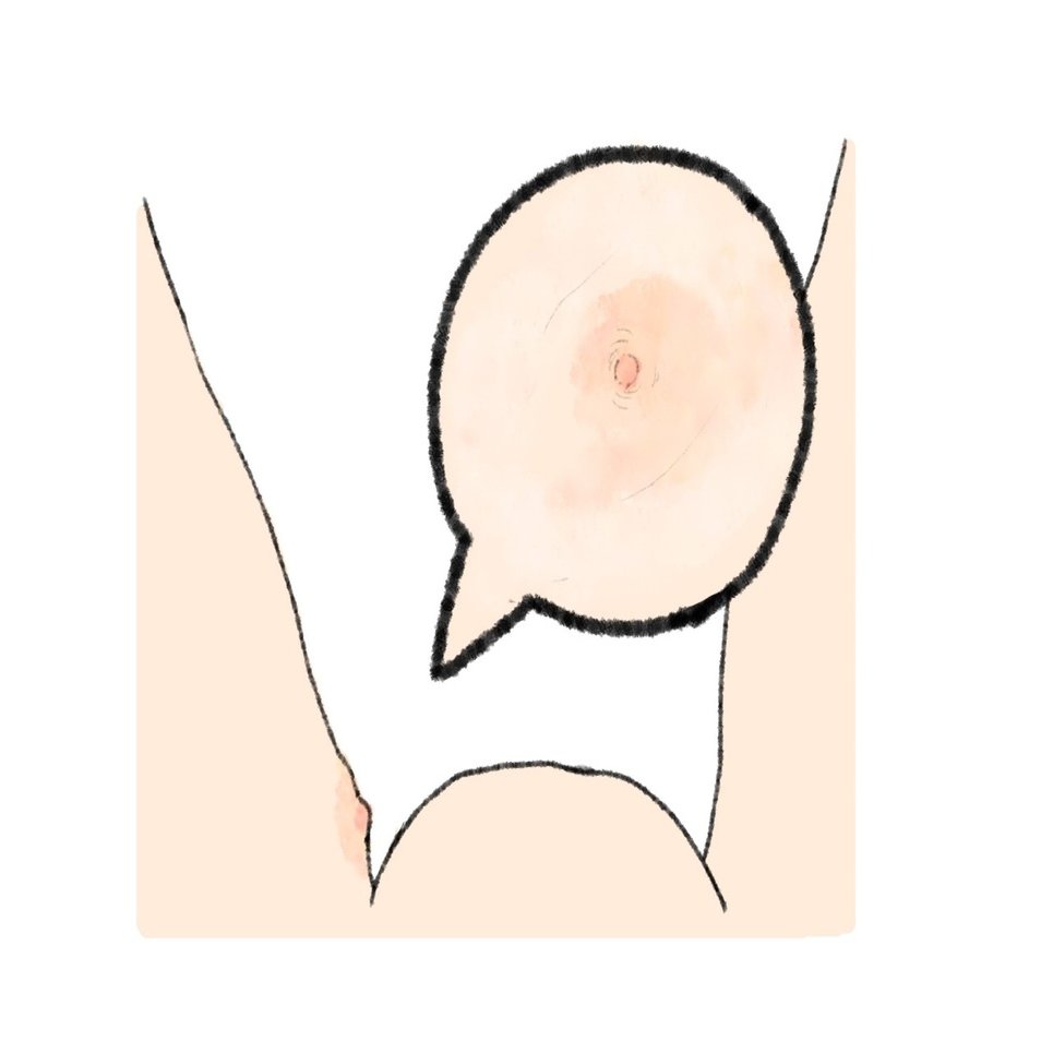 パンツのゴムでできたおできの記録 F Note