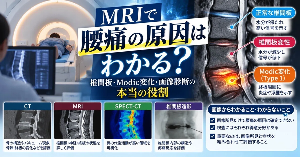 Part 4: Can an MRI identify the cause of lower back pain?｜MIRRO