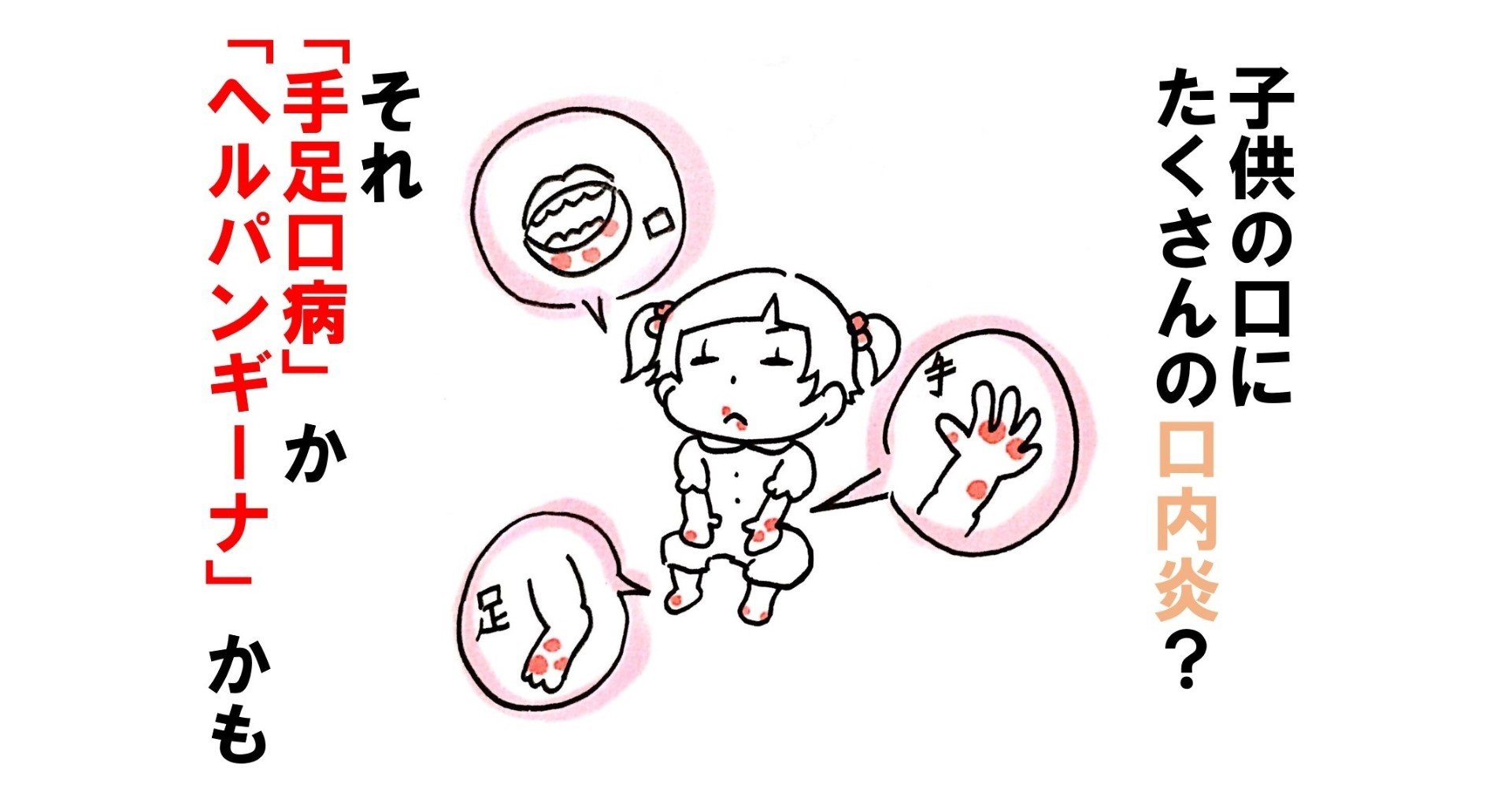 ある日子供の口に 大量の 口内炎が さて あなたはどうする 答えを5秒でお教えします 歯科医師やまて Note