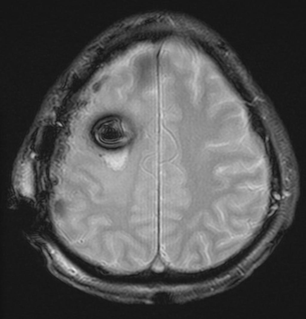 MRI画像｜カネヤマシン