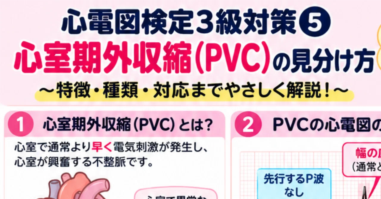 Let's Take the ECG Certification Exam! 5: PVC Explanation｜cupc90fffr