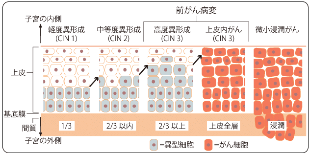 異形成レベル表