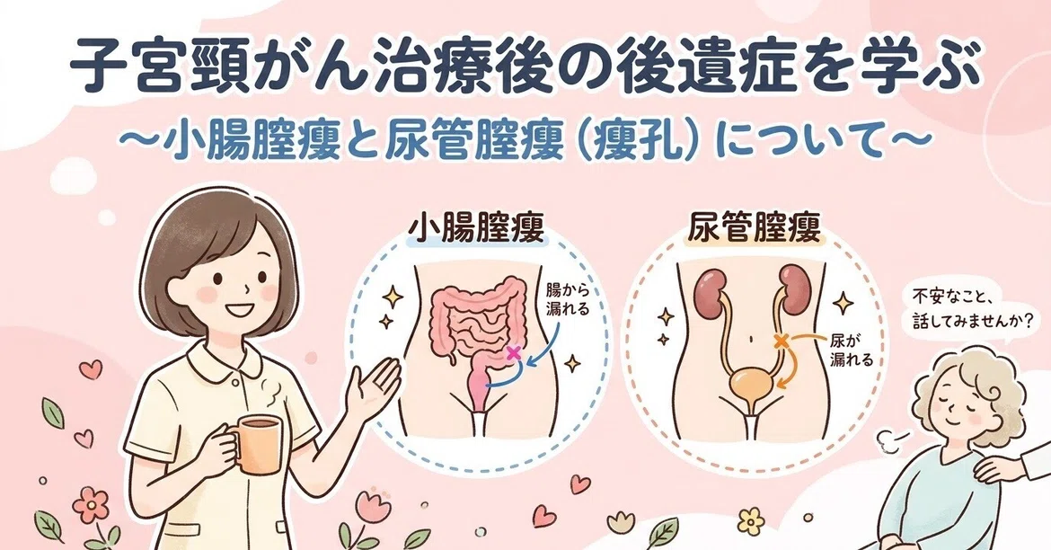 Large Intesting Tissue Sequelae of Cervical Cancer (Small Bowel-Vaginal Fistula and ...