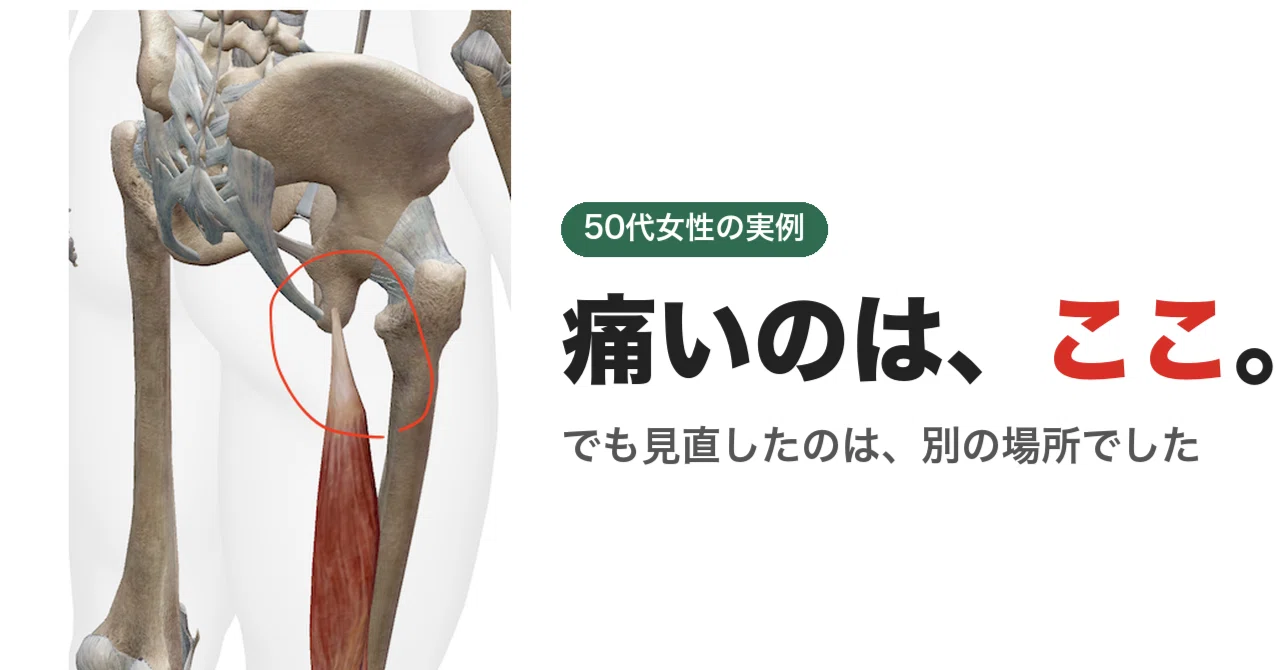Why a woman in her 50s found relief from hamstring pain. What she re ...