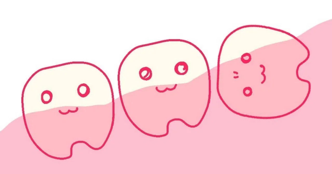 Day 4 of wisdom tooth extraction. A woman nearing 40 finally cries.｜いながきゆみ