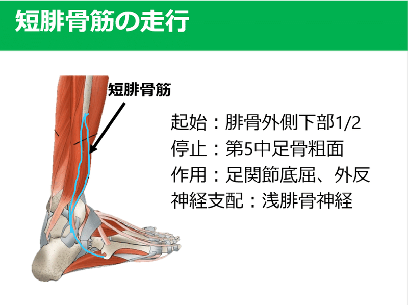 以外と身近に生じている腓骨筋損傷 Y K Note 以外と身近に生じている腓骨筋損傷 Y K Note