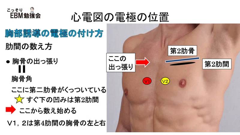 分かる！心電図の電極のはり方｜川野 貴久@分かりやすい心電図