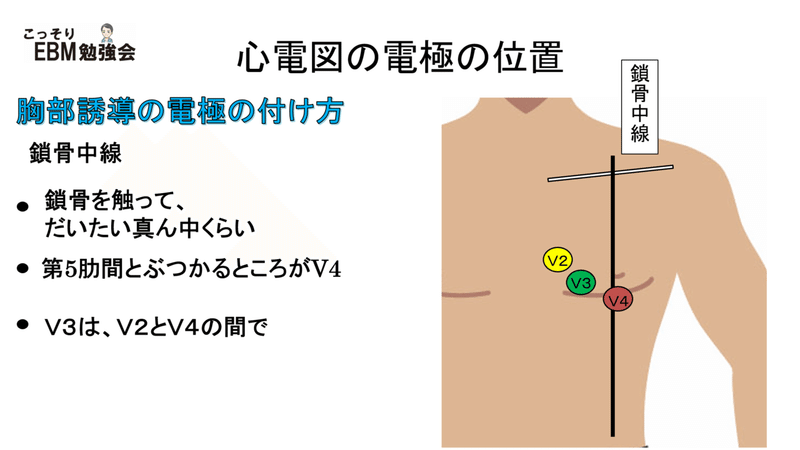 分かる 心電図の電極のはり方 川野 貴久 分かりやすい心電図 Note