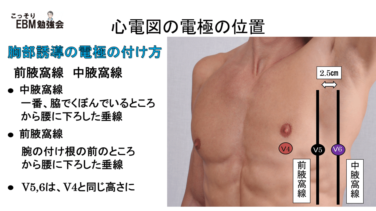 心電図 電極 の 位置