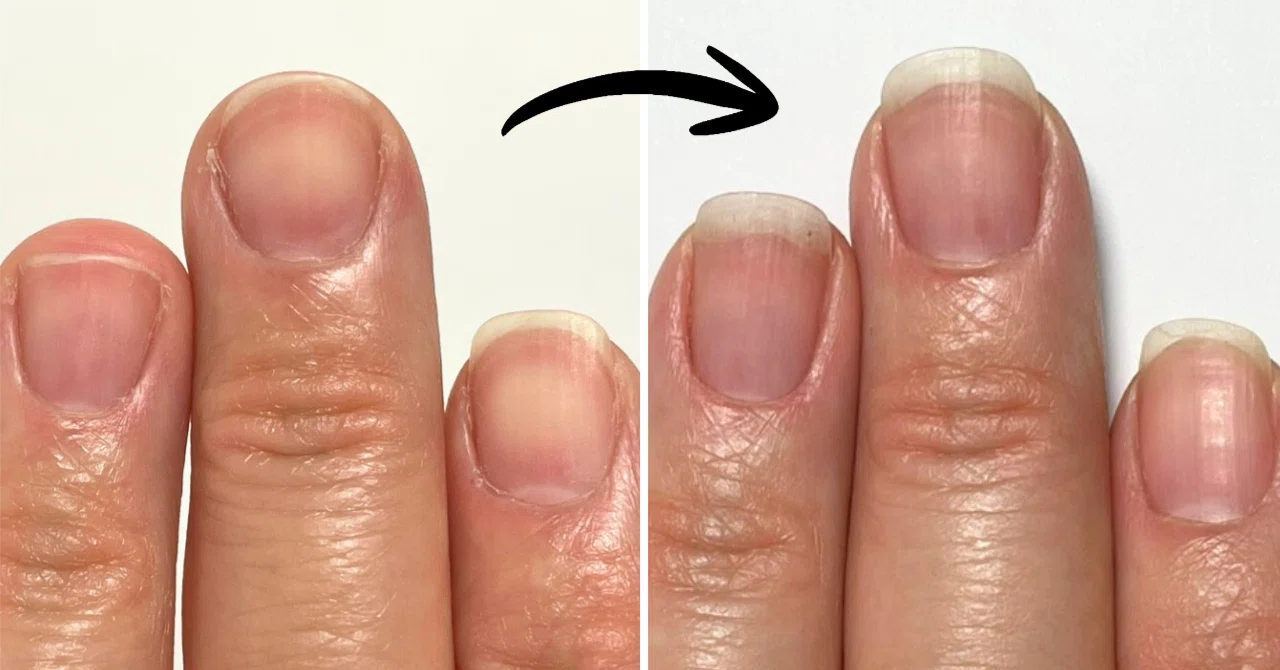 Graduating from Fan-Shaped Nails: Get Long, Narrow Nails with Just Self ...