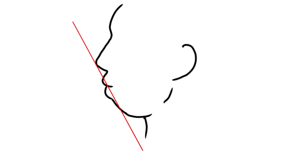The results of a salaryman with a weak chin and protruding mouth six ...
