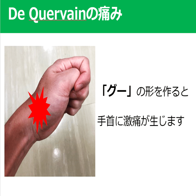 手首が痛い De Quervain ドケルバン病 Y K Note