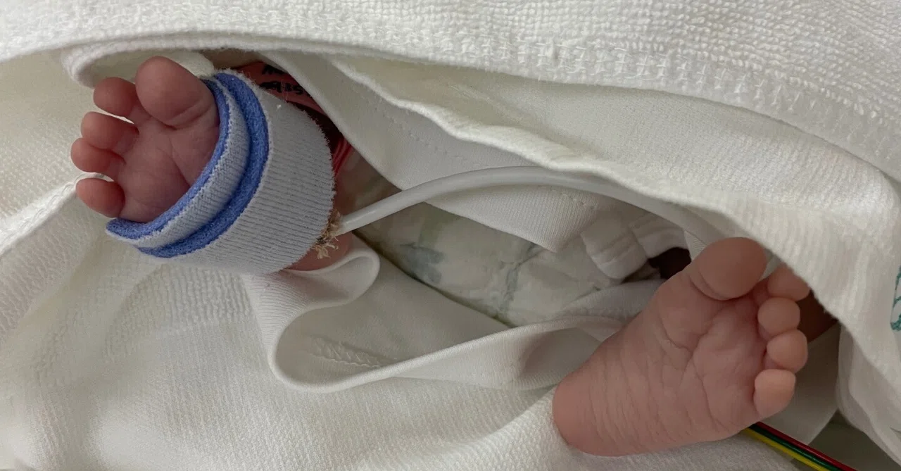 A Complete Record of My Daughter Born with Fetal Growth Restriction at ...