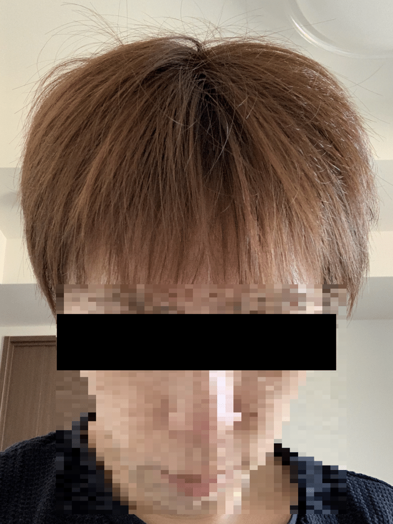 ハゲを薬 Aga治療 なしで自力で克服した方法を大公開 した結果 薄毛から髪がフサフサになった アンチaga式マインド ハゲ克服し太郎 アンチ Aga式マインド発明者 Note