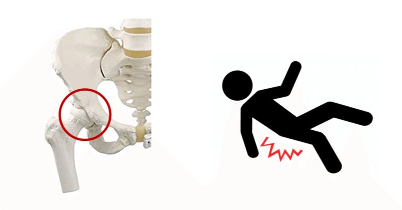 股関節がかたいと転倒しやすい やっさん 動作のバイオメカニクスと転倒予防 note