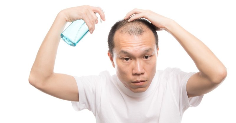 全ハゲ必見 髪が一瞬でフサフサになる方法 ぬけがわはやお Note 全ハゲ必見 髪が一瞬でフサフサになる方法 ぬけがわはやお Note