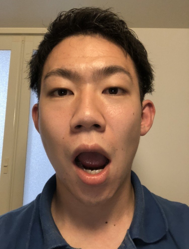 顔 顎の歪みと曲がった口を諦めない その１ 骨格矯正整骨院に行ってみた Y Sonop そのぴー Note