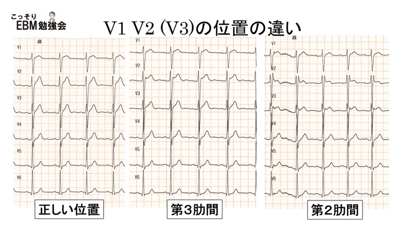 画像13