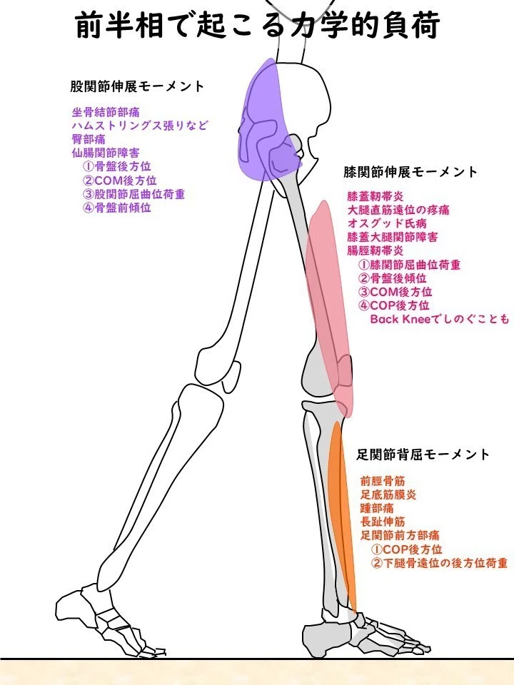 入谷誠の理学療法」から歩行の力学的負荷を4枚のイラストに集約