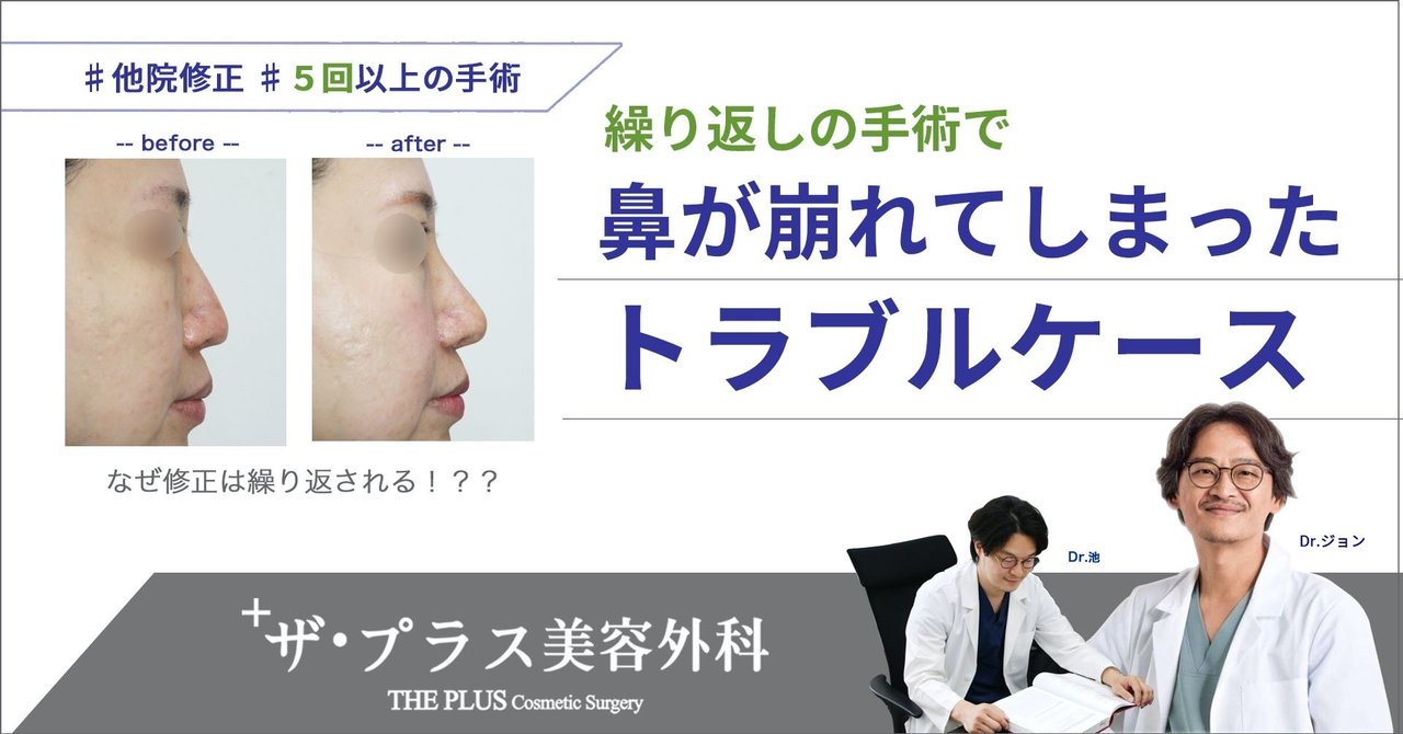鼻整形失敗 の新着タグ記事一覧 Note つくる つながる とどける