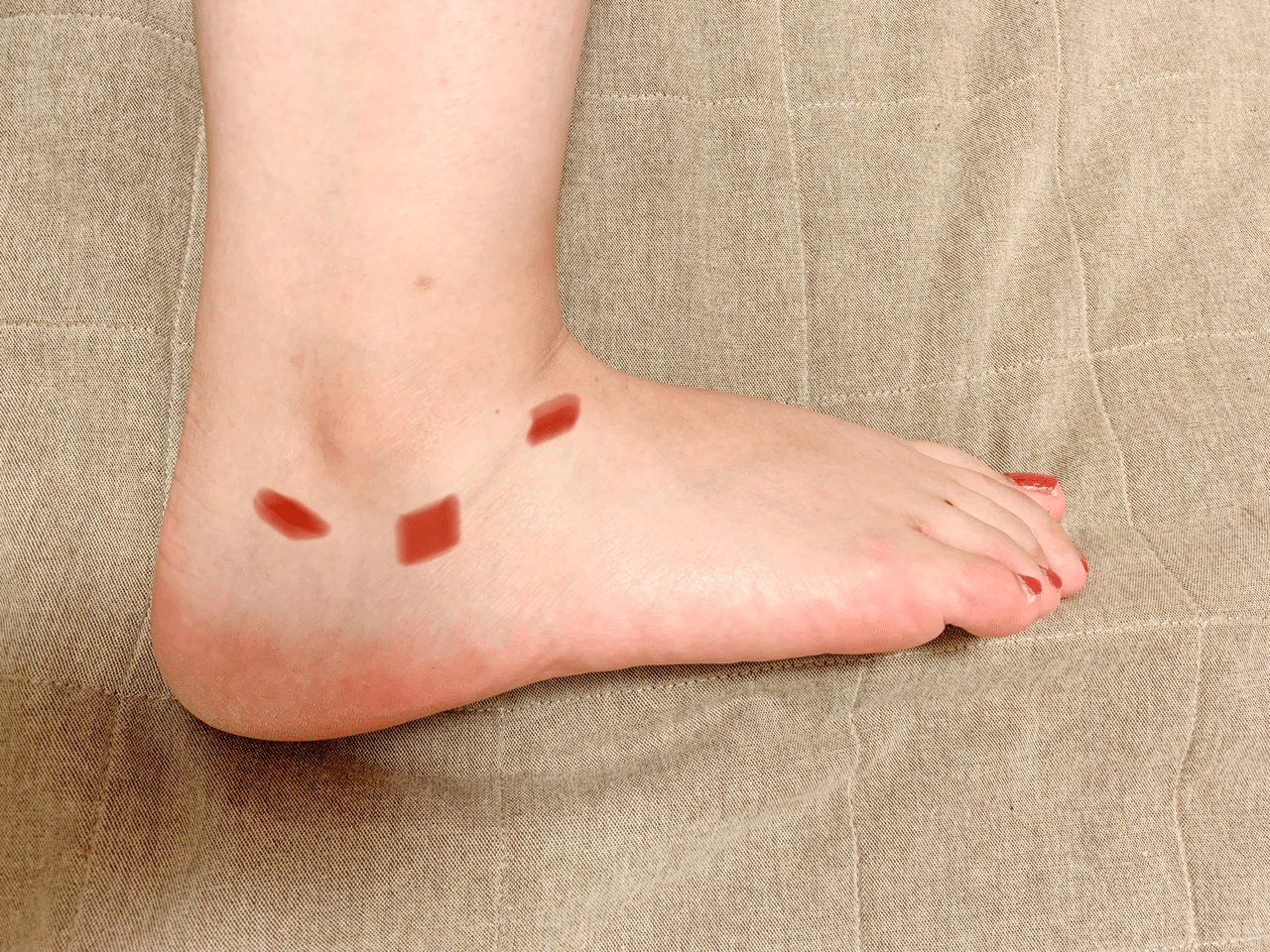 外 くるぶし の 下 押す と 痛い いつまでも足首が痛い原因と治し方 外 くるぶし の 下 押す と 痛い いつまでも足首が痛い原因と治し方