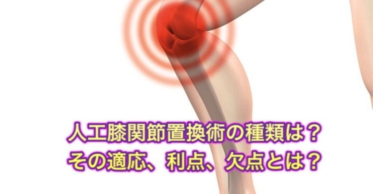 人工膝関節置換術の種類はいくつある？その適応、利点、欠点とは