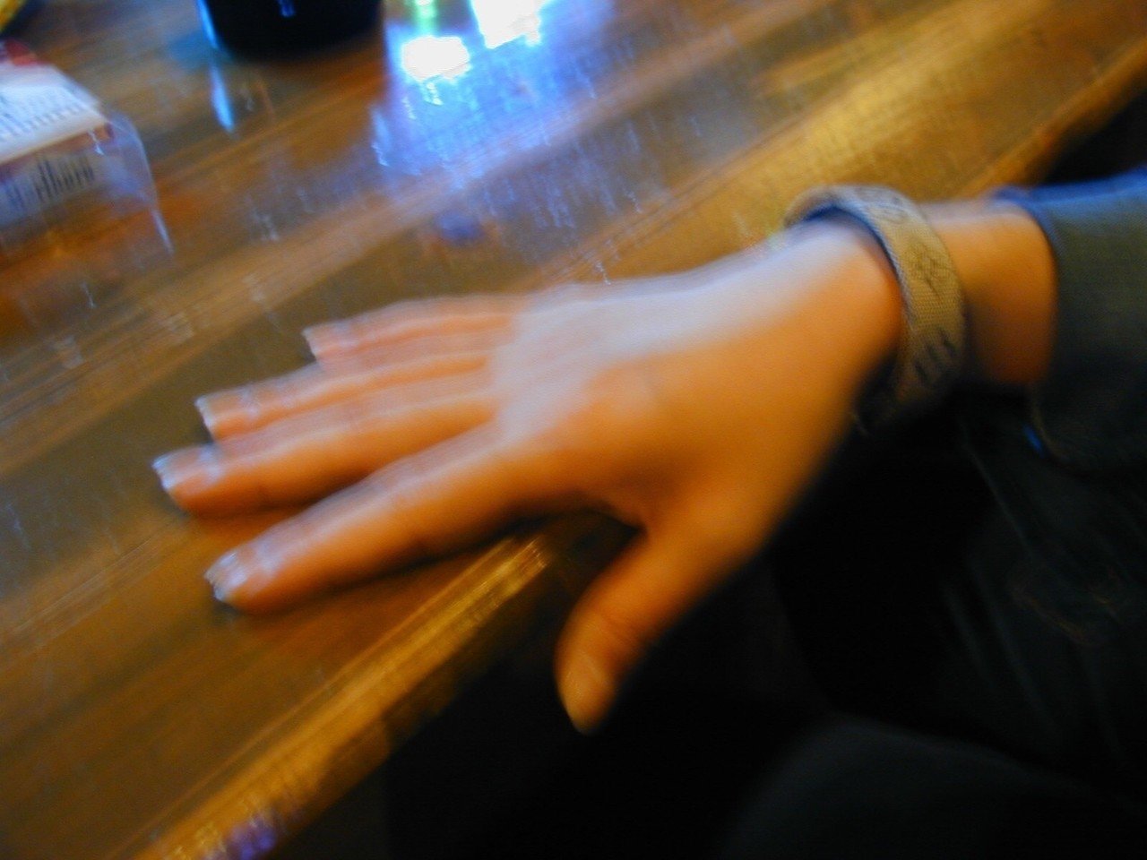 神様の爪が僕を引っ掻くんだ 君の存在や 君の言葉や 音楽が花のように咲くことや 恋という野蛮なものが 神様の爪のように僕の心を引っ掻くんだ ああ 愛しき日常の傷よ 爪の傷を愛する 荒木スミシ Note