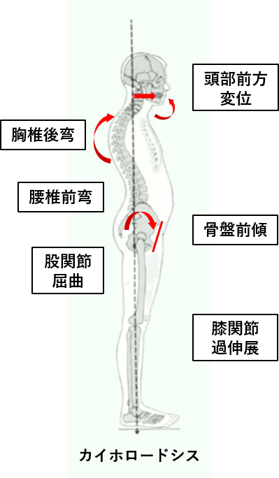 姿勢評価とエクササイズの教科書 理学療法士による理学療法士のためのnote Note