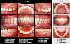 良い歯医者を見つける唯一の方法 おてつ Note