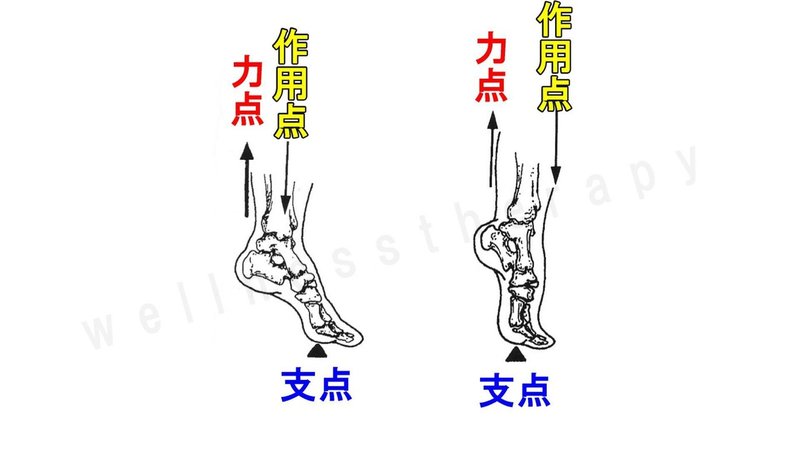 てこを理解しよう 第２のてこ 何でも正直に言っちゃうカイロプラクター Note