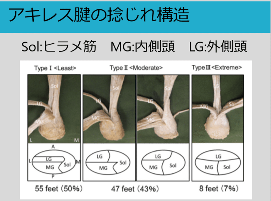 アキレス腱断裂 基礎編 Y K Note アキレス腱断裂 基礎編 Y K Note