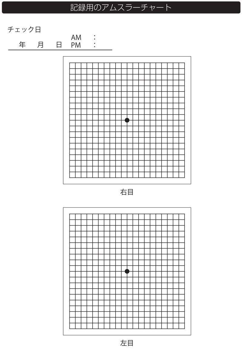 目の病気は早期発見が大事 異常がないかチェックできるアムスラーチャートの使い方 翔泳社の福祉の本 Note