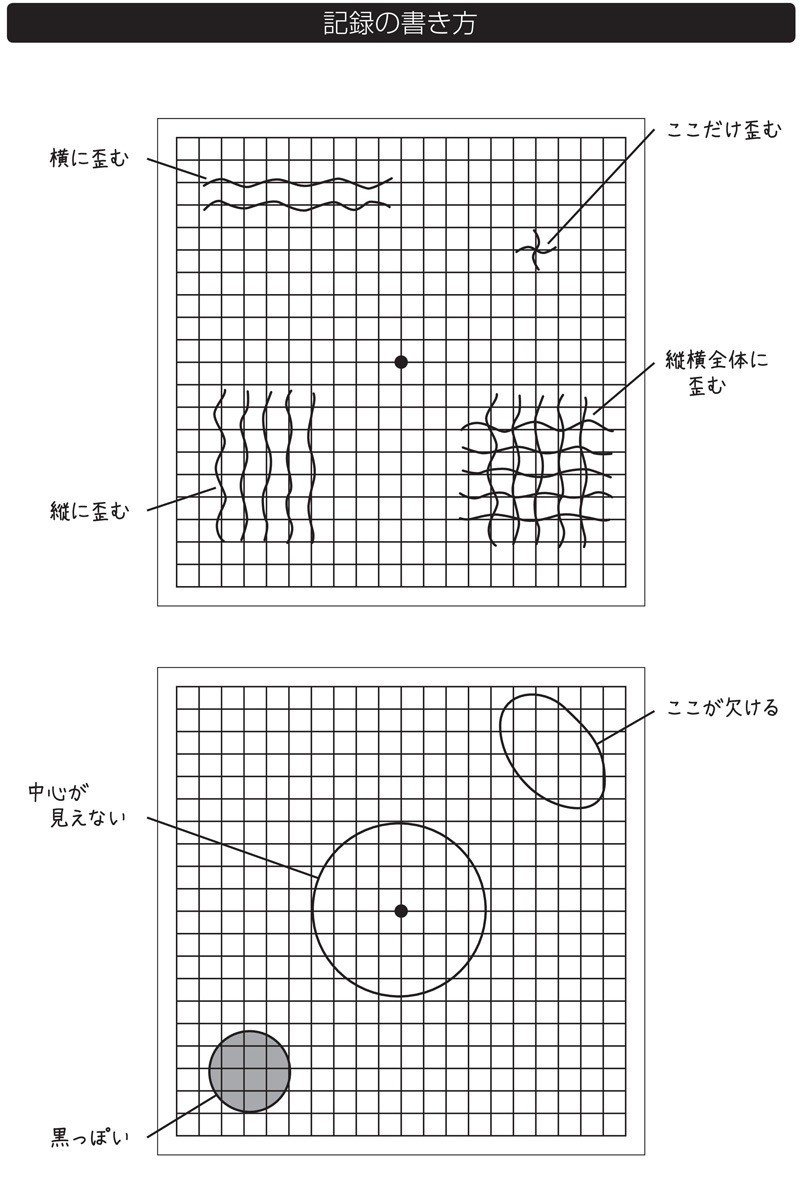 目の病気は早期発見が大事 異常がないかチェックできるアムスラーチャートの使い方 翔泳社の福祉の本 Note