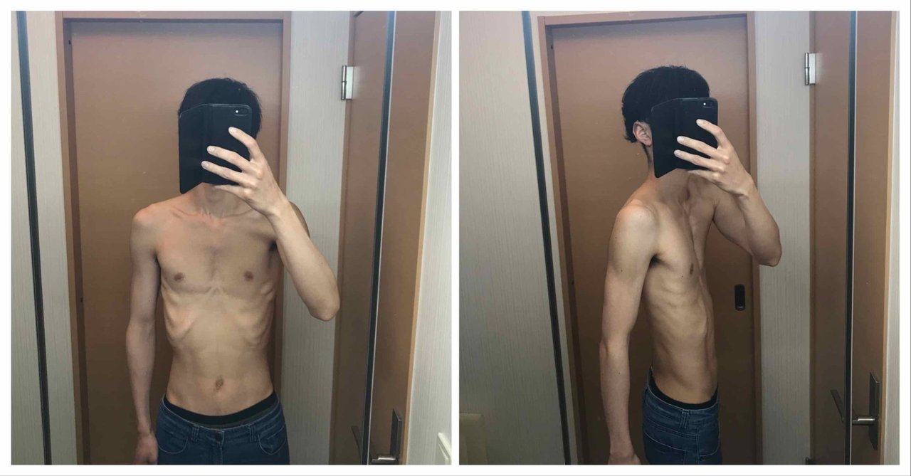 毎日クロワッサン1個では太れない 拒食症の方の話から学ぶ食べることの大切さ てる ガリガリ集まれ Note 毎日クロワッサン1個では太れない 拒食症の方の話から学ぶ食べることの大切さ てる ガリガリ集まれ Note