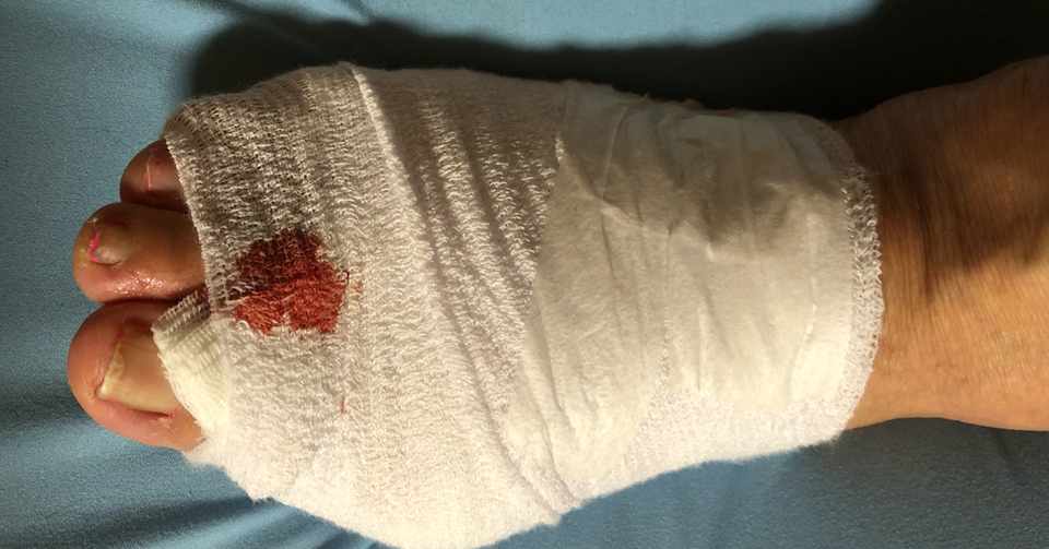 ムカデに刺されたら Maa Note