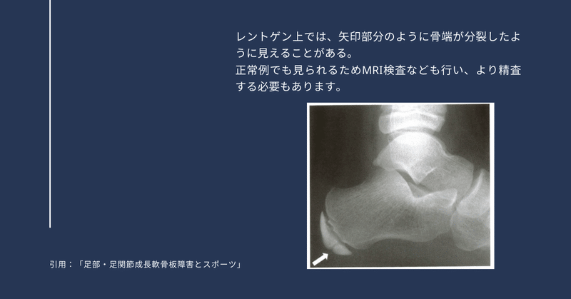成長期のかかとの痛みに迫る サッカー選手 向けフィジカルサポートnote 石橋 哲平 Note