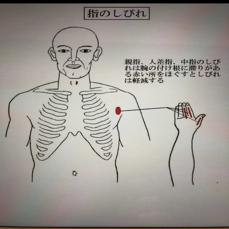 指や腕の痺れありませんか？｜竹元泰子（膝楽院）