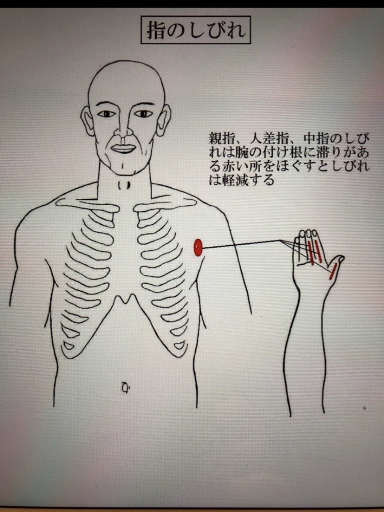 指や腕の痺れありませんか？｜竹元泰子（膝楽院）