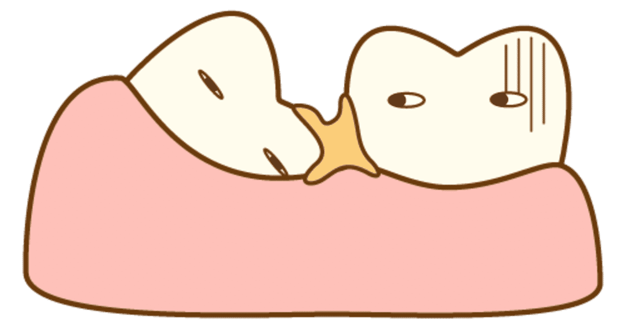 親知らず抜歯 の新着タグ記事一覧 Note つくる つながる とどける