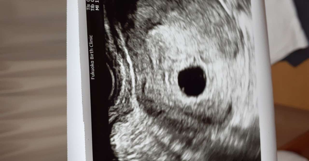 はじめての稽留流産 最終話 リタ ミターメイ Note