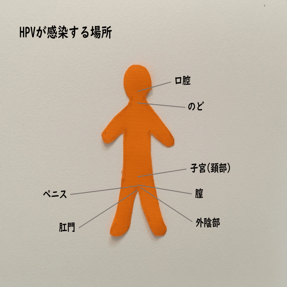 男子にもhpvワクチン接種を Hpvがひきおこす子宮頚がん以外のがん アクロストン 10歳からのカラダ 性 ココロのいろいろブック 発売中 Note