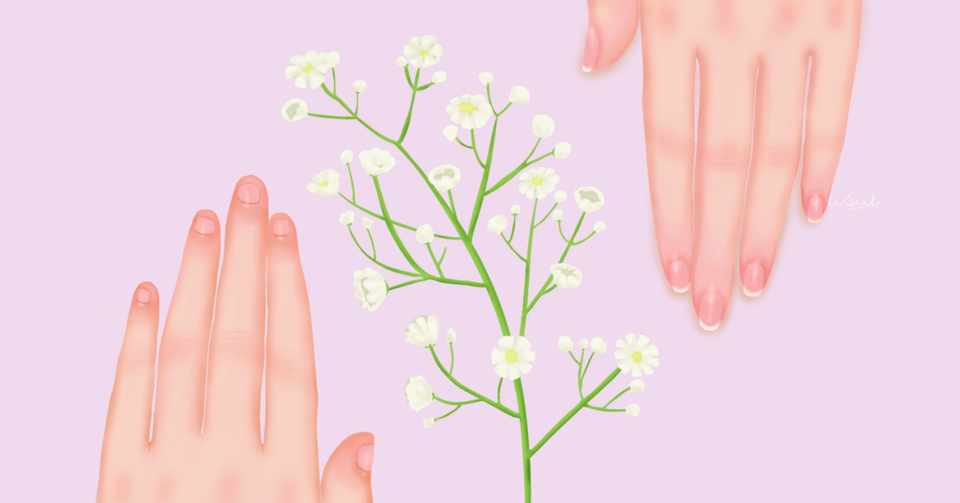 指先弄りに伴う深爪と行動の背景 うすい Note