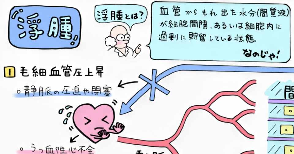 病理学講義４ 循環障害 浮腫の原因４つ のうと医療専門学校 Note