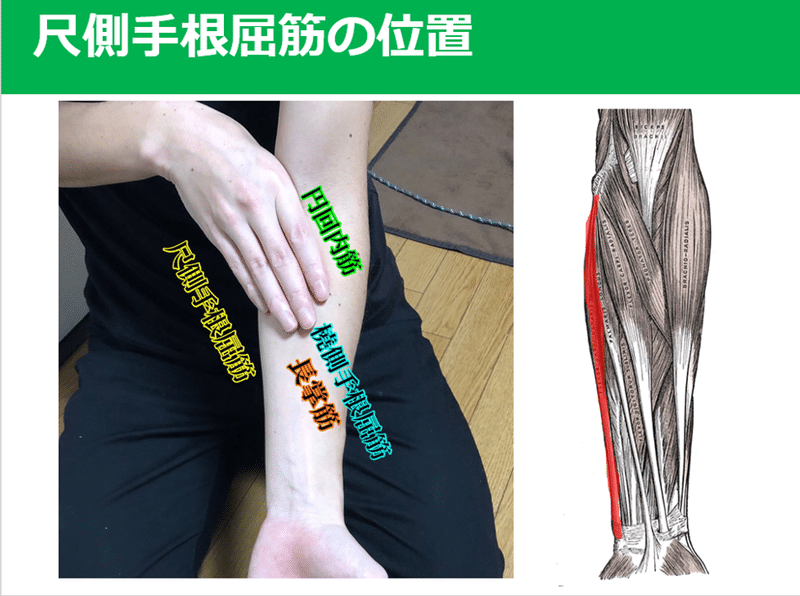 尺骨神経絞扼の臨床症状 評価 介入 Y K Note 尺骨神経絞扼の臨床症状 評価 介入 Y K Note