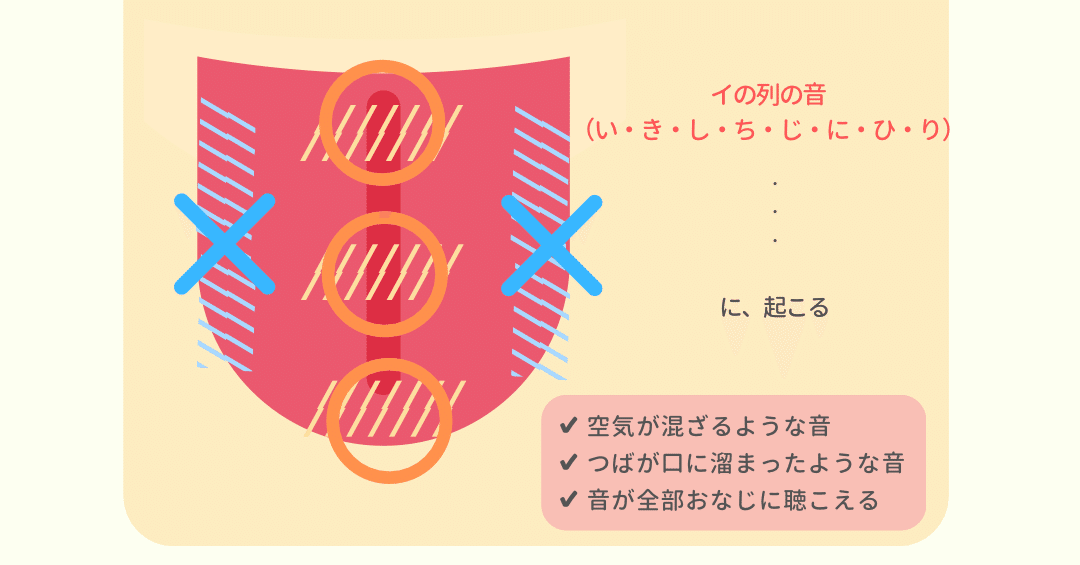 Q A 大人だけど発音 滑舌が悪い人へ 言語聴覚士の側音化構音矯正 てらだ なな なな先生 Note Q A 大人だけど発音 滑舌が悪い人へ 言語聴覚士の側音化構音矯正 てらだ なな なな先生 Note