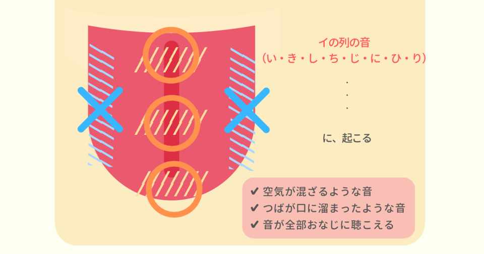 Q A 大人だけど発音 滑舌が悪い人へ 言語聴覚士の側音化構音矯正 ななさん Note