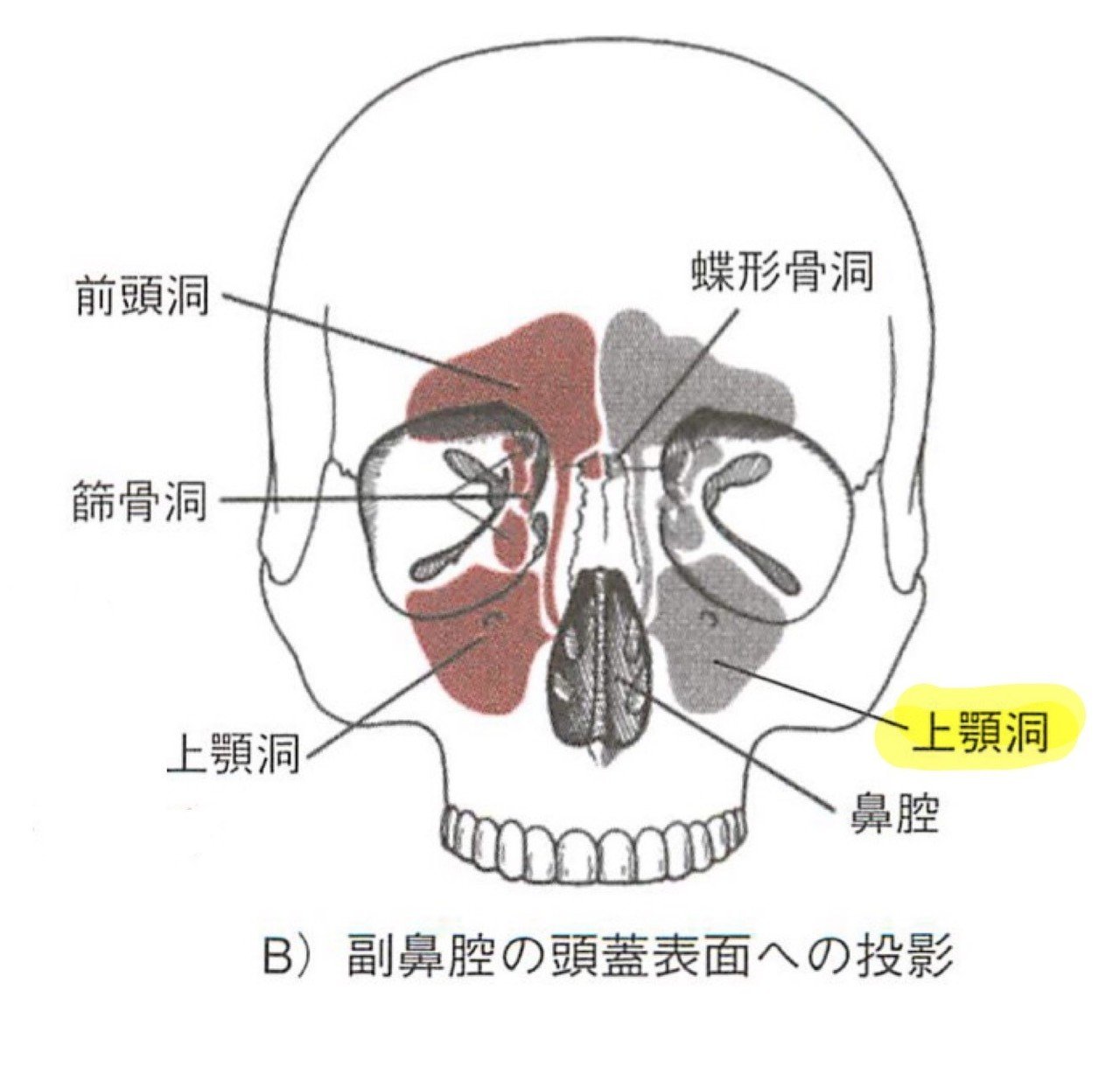 繰り返す 炎 副 鼻腔